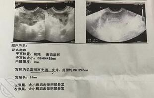 带妈妈去小诊所做流产0